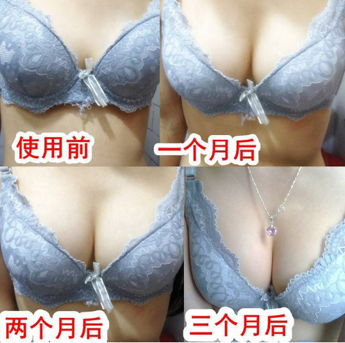 抖音俏美韵丰韵美乳霜真的能丰胸吗？记者揭露真实效果..